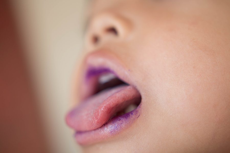 4 Things Parents Need to Know About Hand, Foot and Mouth Disease