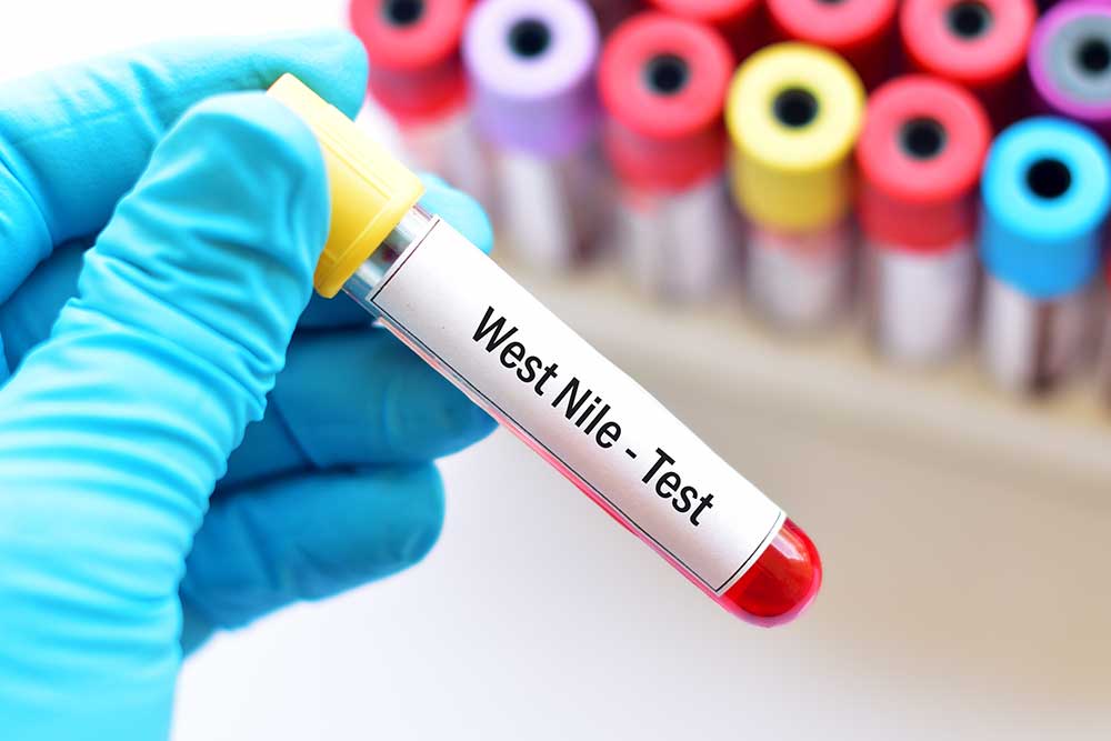 West Nile Virus Tests and Treatment Options